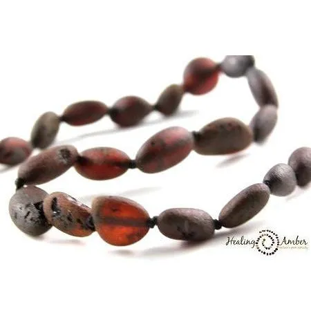 Healing Amber Bracelet/Anklet 6.5 inches