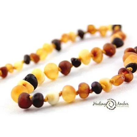 Healing Amber Bracelet/Anklet 6.5 inches