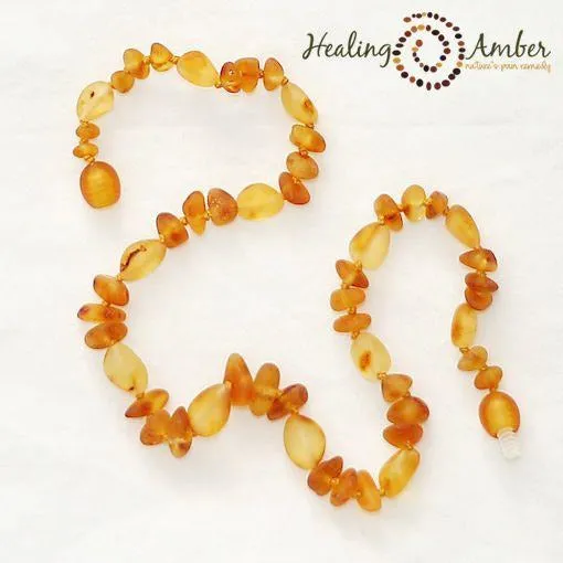 Healing Amber Bracelet/Anklet 6.5 inches
